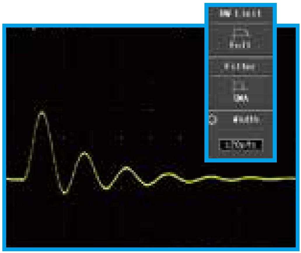 SMA: ON width = ±20pts