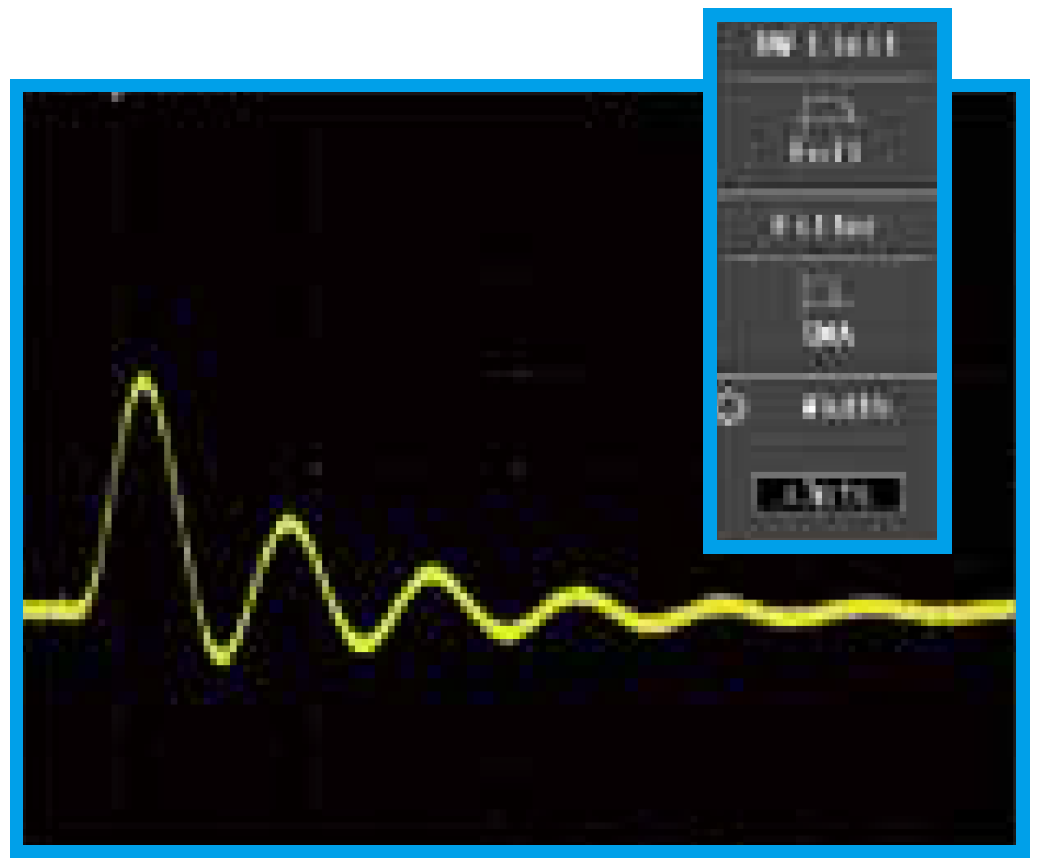 SMA: ON width = ±3pts